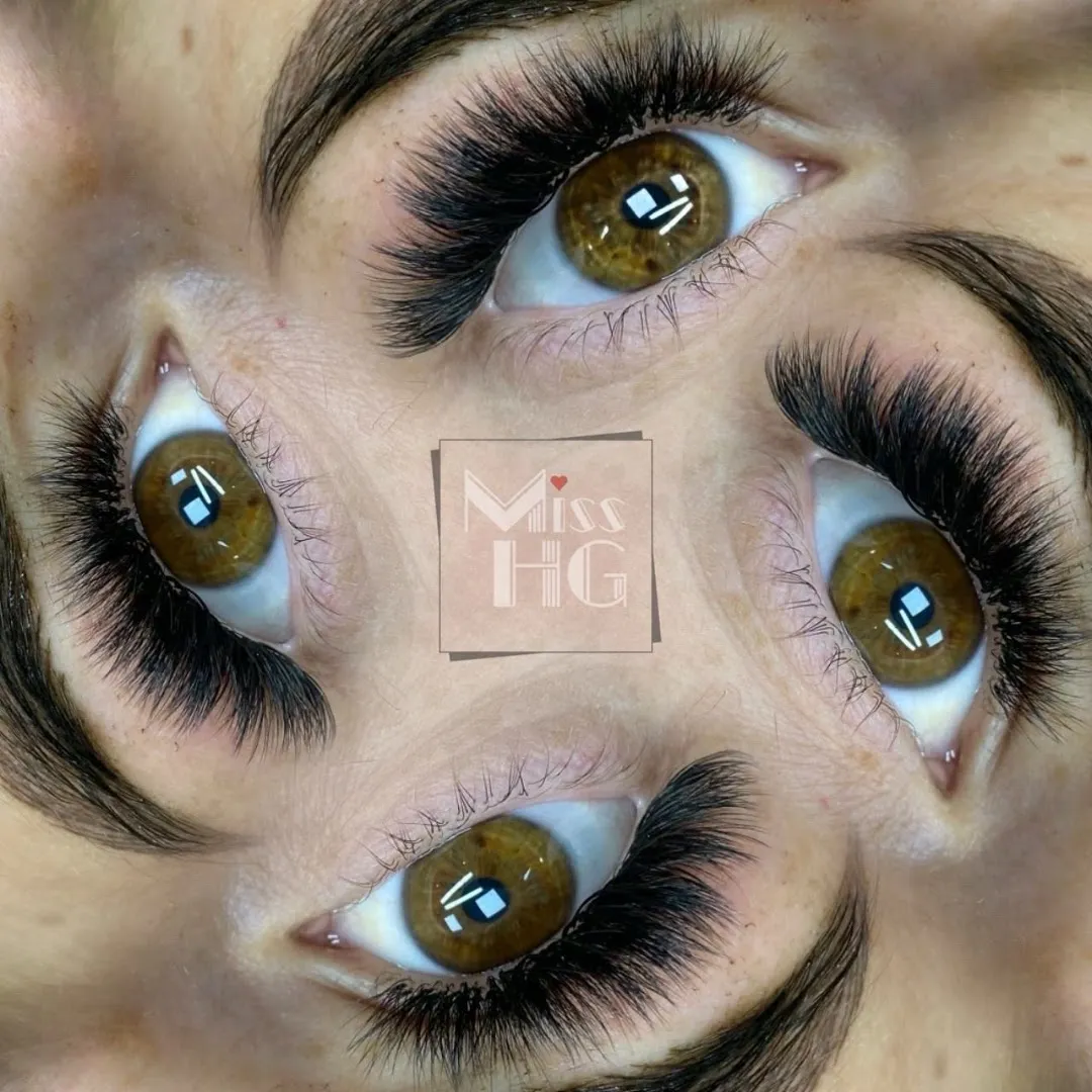 Lip fillers — Miss HG — Beauty salon in Romford