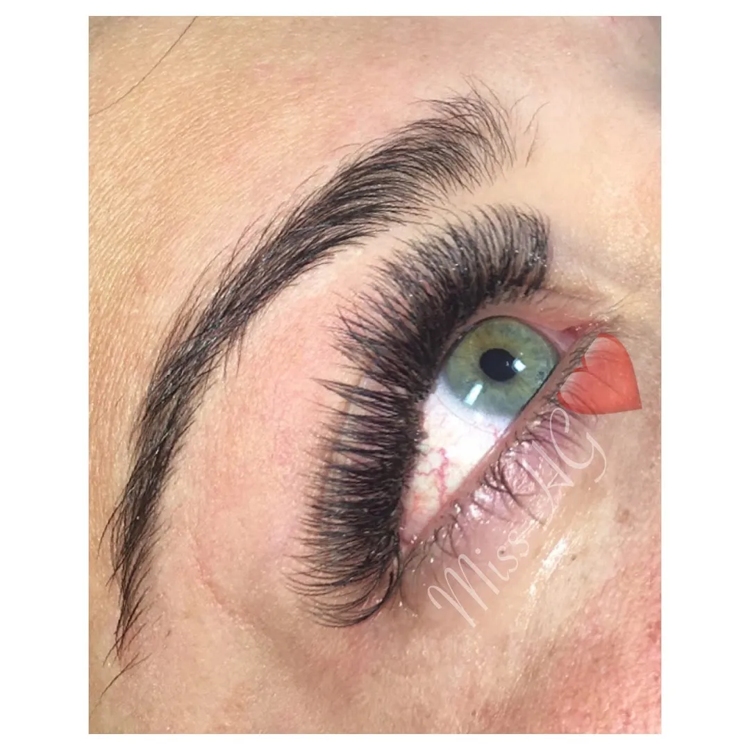 Botox — Miss HG — Beauty salon in Romford