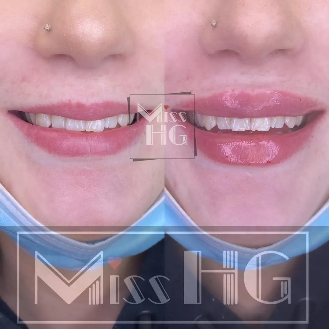LVL lash treatment — Miss HG — Beauty salon in Romford